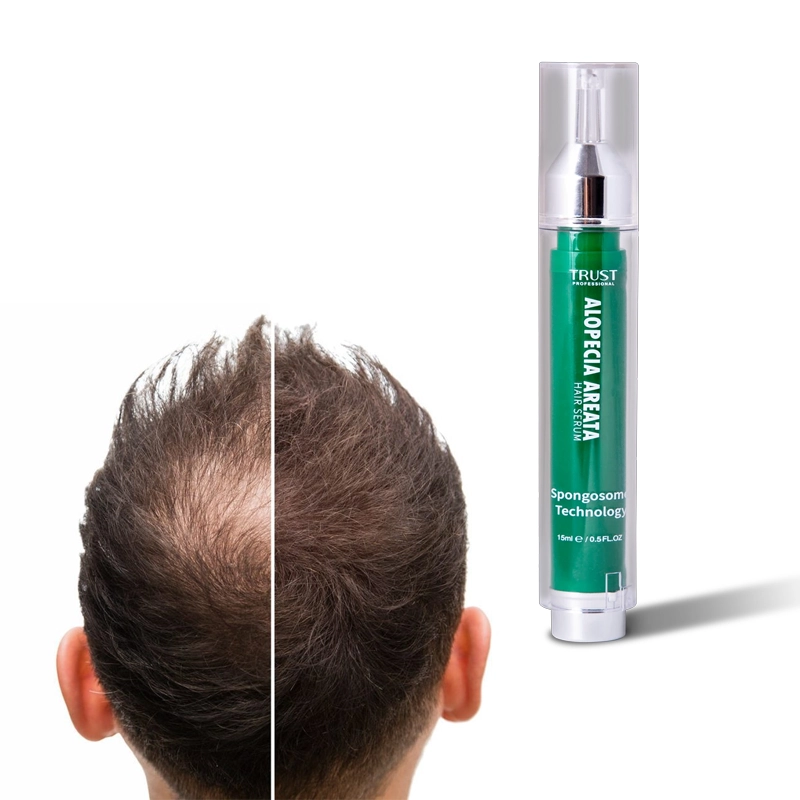 کاربرد سرم بهبود دهنده ریزش سکه ای مو تراست